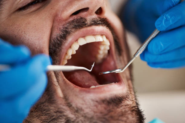 Best Walk-In Dentist Near Me  in Wapakoneta, OH